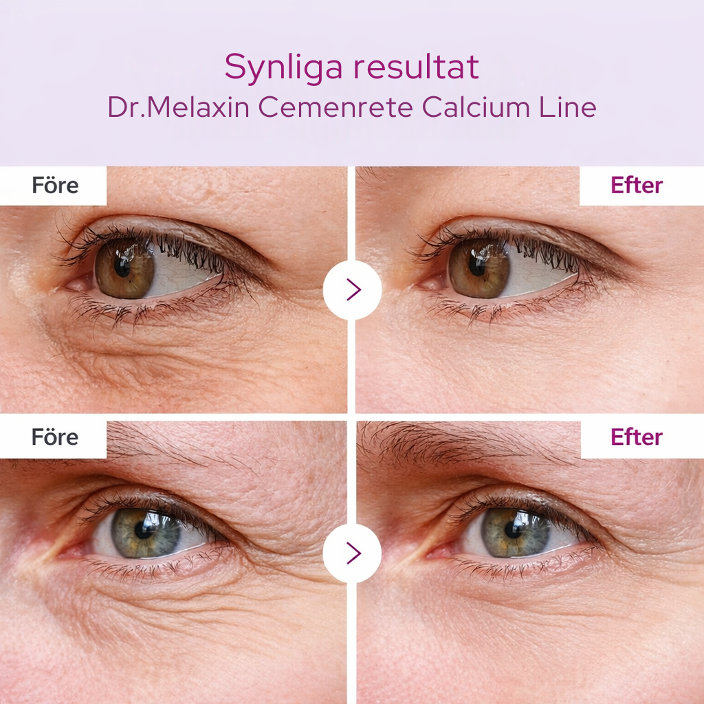 Cemenrete Calcium Volume Ögonpatchar