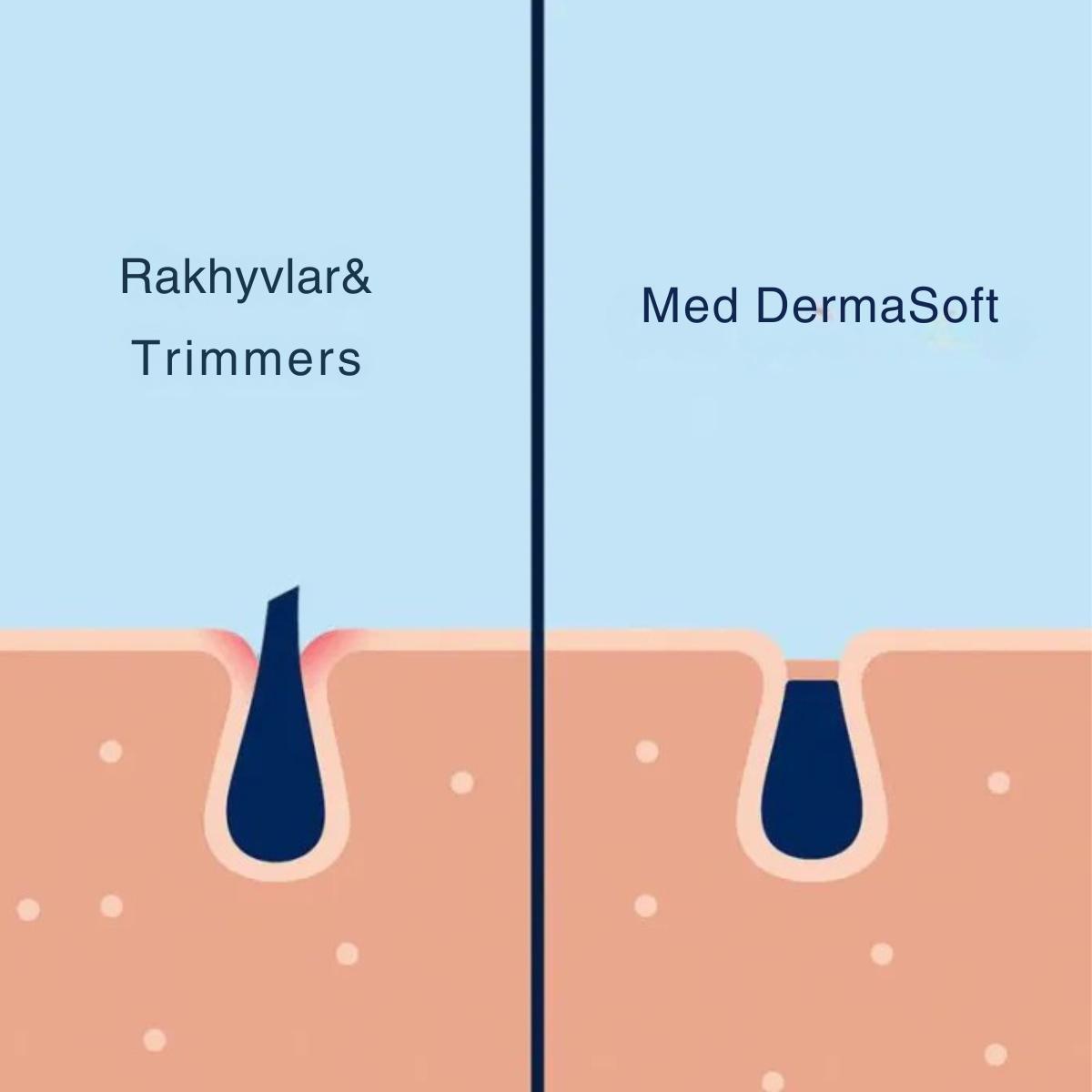 DermaSoft – Skonsam hårborttagningskräm för känsliga områden